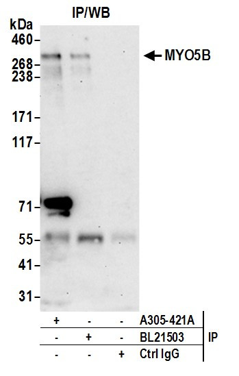 MYO5B Antibody in Immunoprecipitation (IP)