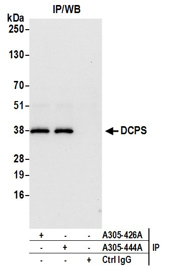 DCPS Antibody in Immunoprecipitation (IP)