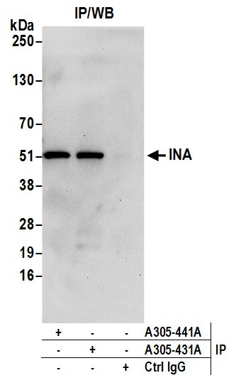 INA Antibody in Immunoprecipitation (IP)