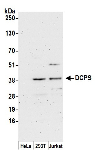 DCPS Antibody in Western Blot (WB)