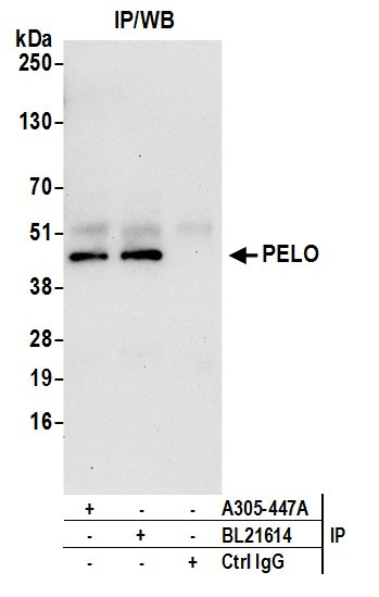 PELO Antibody in Immunoprecipitation (IP)