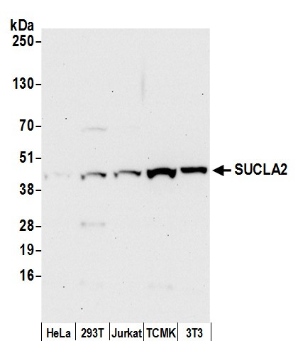 SUCLA2 Antibody in Western Blot (WB)