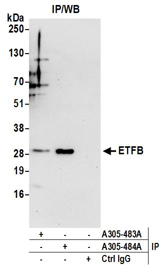 ETFB Antibody in Immunoprecipitation (IP)