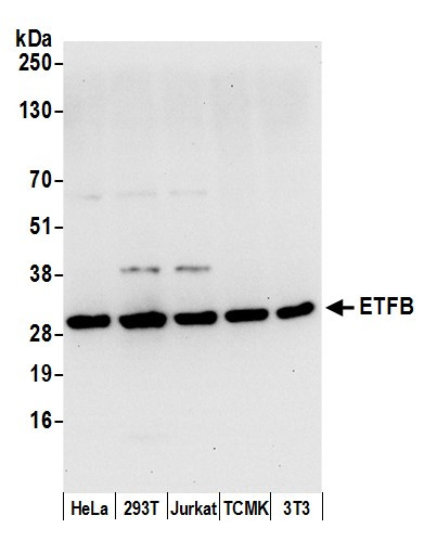 ETFB Antibody in Western Blot (WB)