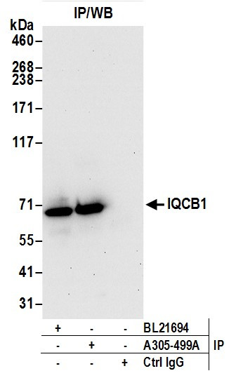 IQCB1 Antibody in Immunoprecipitation (IP)