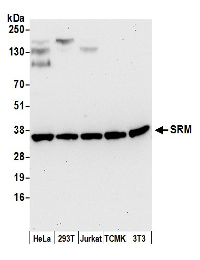 SRM Antibody in Western Blot (WB)