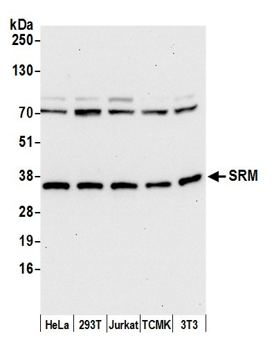 SRM Antibody in Western Blot (WB)