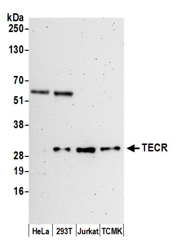 TECR Antibody in Western Blot (WB)