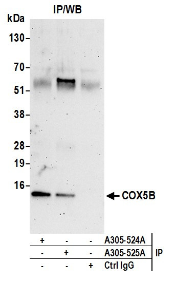 COX5B Antibody in Immunoprecipitation (IP)