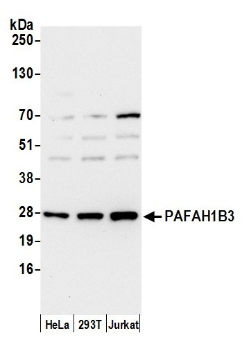 PAFAH1B3 Antibody in Western Blot (WB)