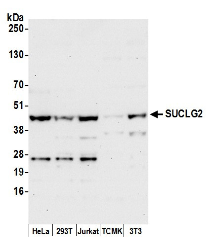 SUCLG2 Antibody in Western Blot (WB)