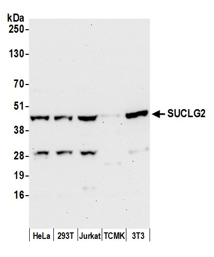 SUCLG2 Antibody in Western Blot (WB)