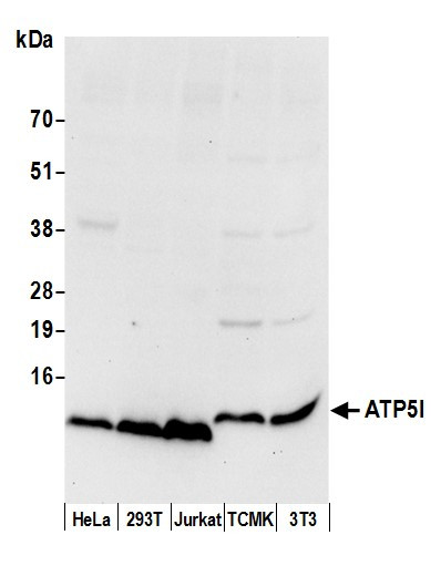 ATP5I Antibody in Western Blot (WB)