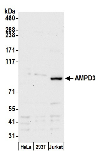 AMPD3 Antibody in Western Blot (WB)