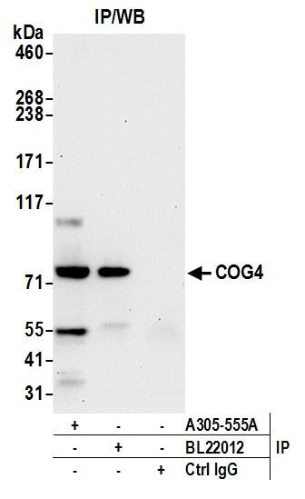 COG4 Antibody in Immunoprecipitation (IP)