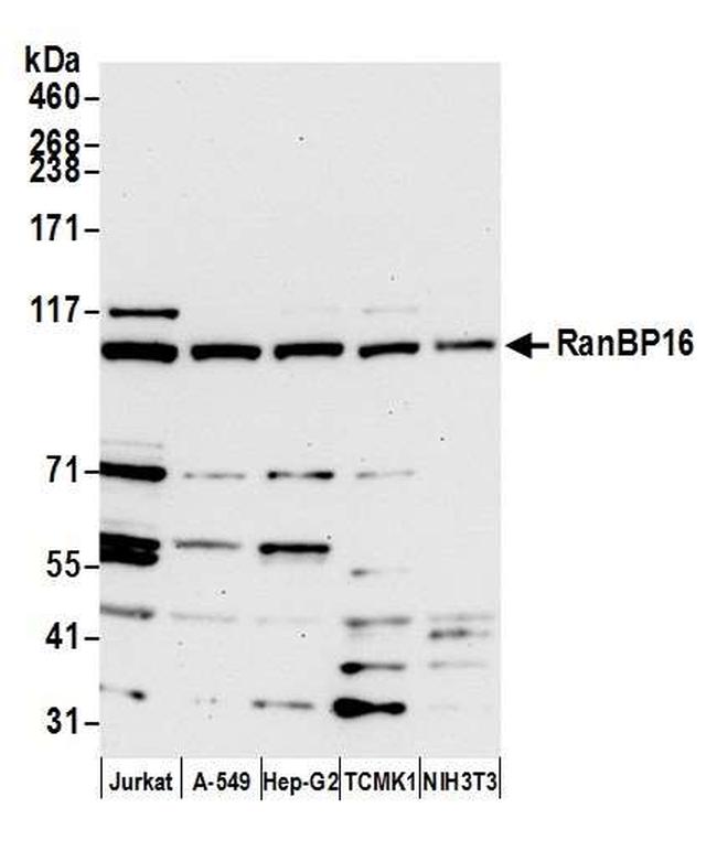 RanBP16 Antibody in Western Blot (WB)