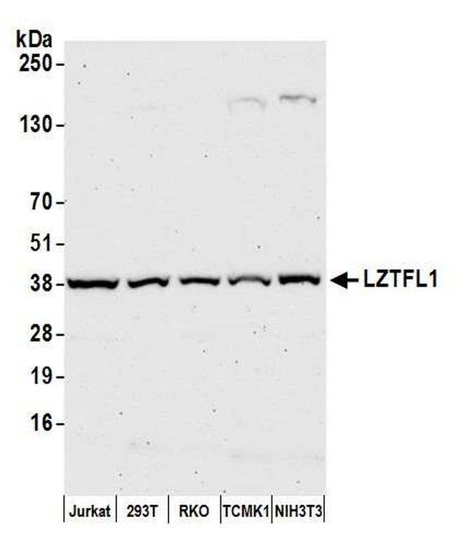 LZTFL1 Antibody in Western Blot (WB)