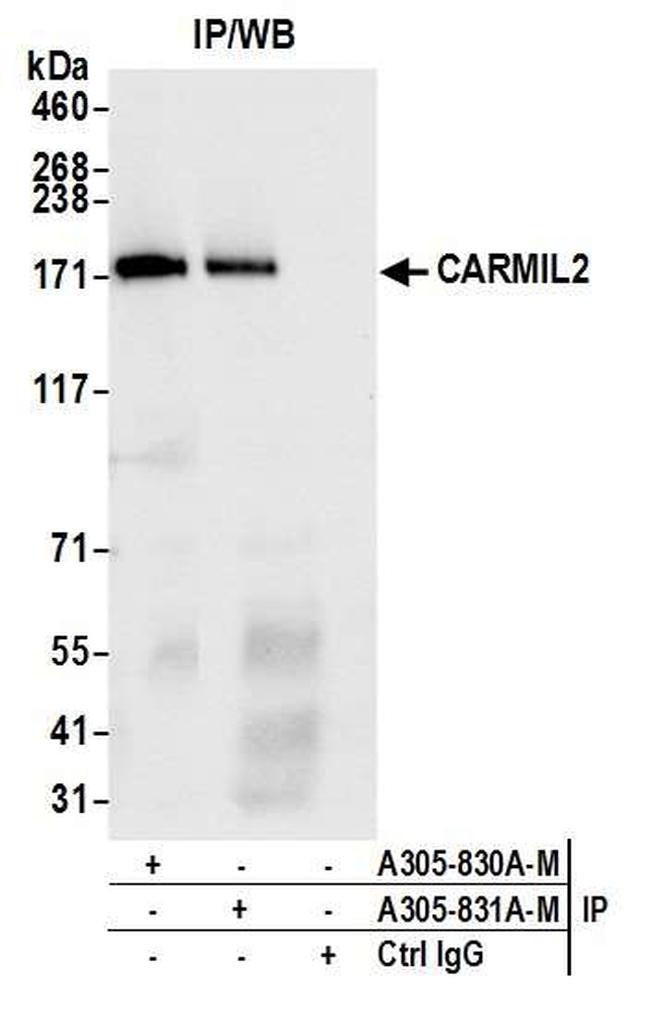 CARMIL2 Antibody in Immunoprecipitation (IP)