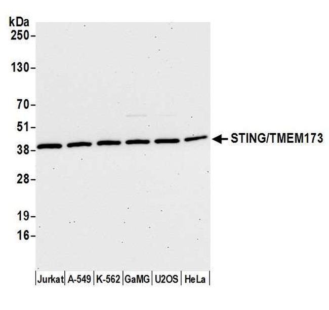 STING/TMEM173 Antibody in Western Blot (WB)