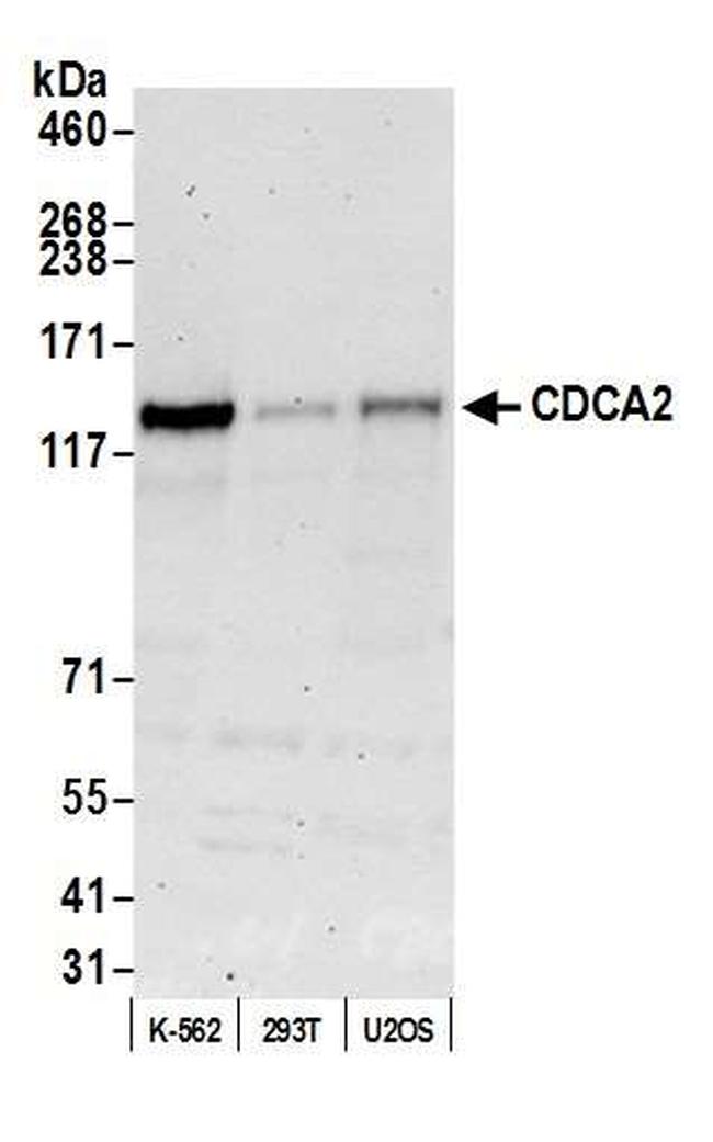 CDCA2 Antibody in Western Blot (WB)