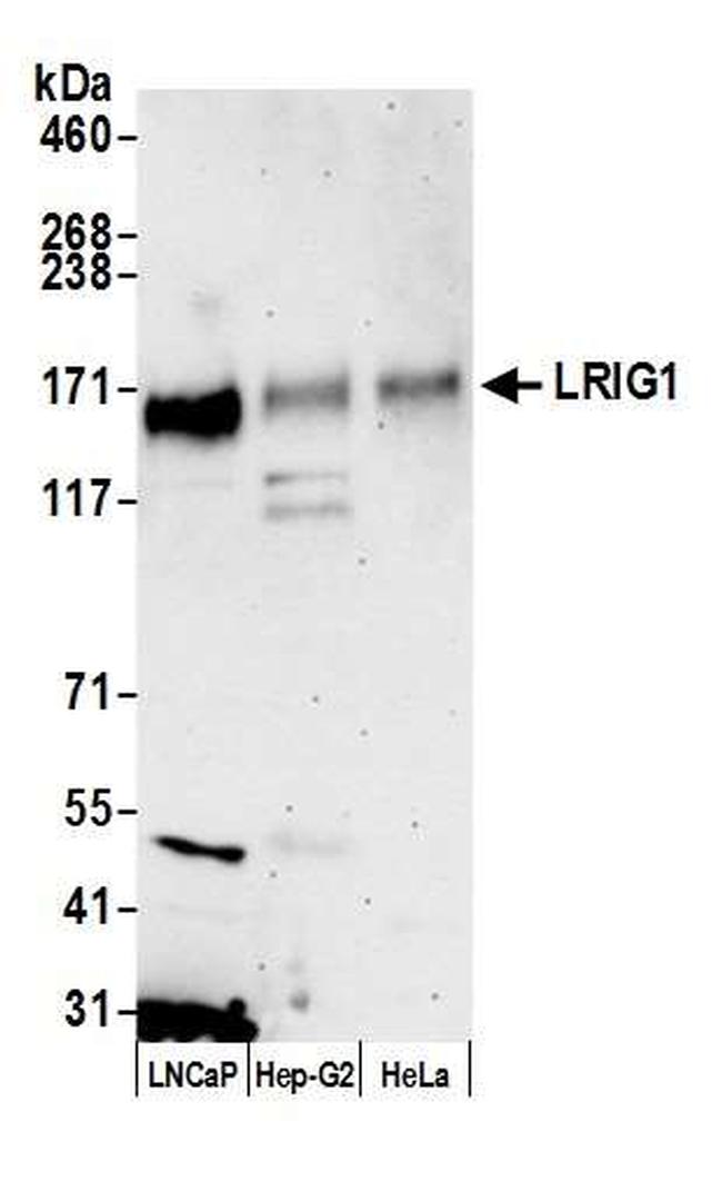 LRIG1 Antibody in Western Blot (WB)