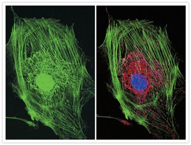 Mouse IgG (H+L) Cross-Adsorbed Secondary Antibody in Immunocytochemistry (ICC/IF)