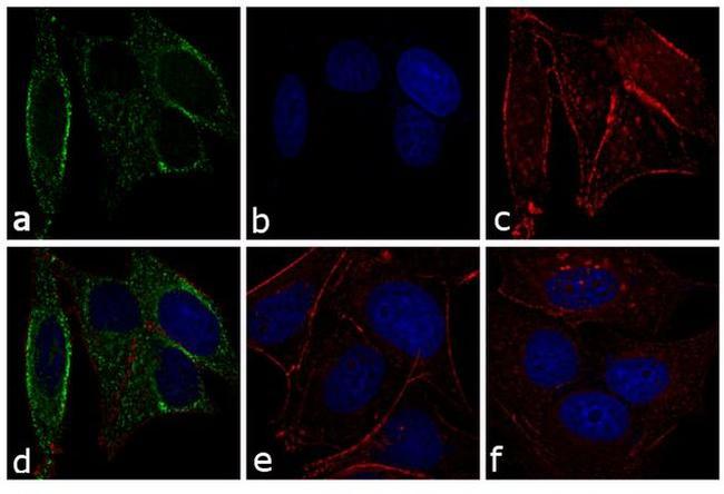 Mouse IgG (H+L) Secondary Antibody in Immunocytochemistry (ICC/IF)