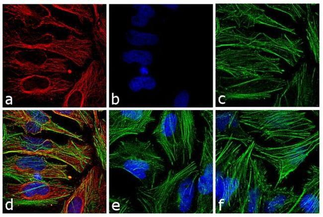 Mouse IgG (H+L) Highly Cross-Adsorbed Secondary Antibody in Immunocytochemistry (ICC/IF)