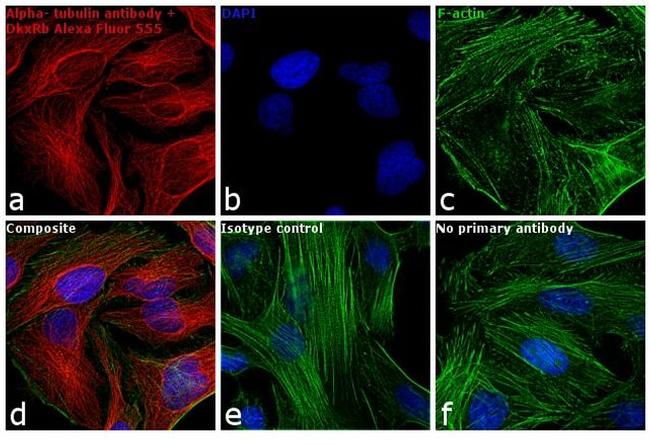 Rabbit IgG (H+L) Highly Cross-Adsorbed Secondary Antibody in Immunocytochemistry (ICC/IF)