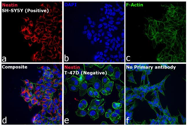 Mouse IgG (H+L) Highly Cross-Adsorbed Secondary Antibody in Immunocytochemistry (ICC/IF)