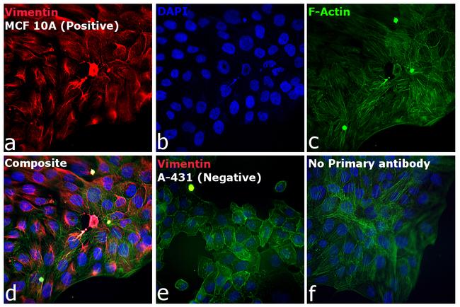 Rabbit IgG (H+L) Highly Cross-Adsorbed Secondary Antibody in Immunocytochemistry (ICC/IF)