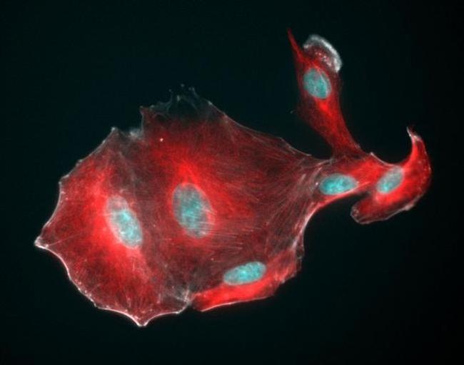 Mouse IgG (H+L) Highly Cross-Adsorbed Secondary Antibody in Immunocytochemistry (ICC/IF)