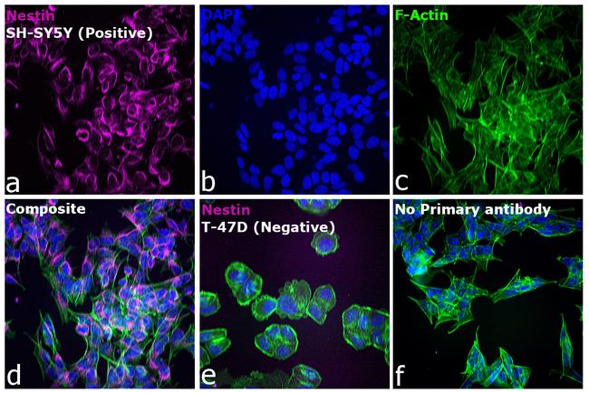 Mouse IgG (H+L) Highly Cross-Adsorbed Secondary Antibody in Immunocytochemistry (ICC/IF)