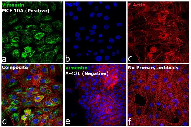 Rabbit IgG (H+L) Highly Cross-Adsorbed Secondary Antibody in Immunocytochemistry (ICC/IF)