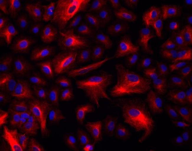 Rabbit IgG (H+L) Highly Cross-Adsorbed Secondary Antibody in Immunocytochemistry (ICC/IF)