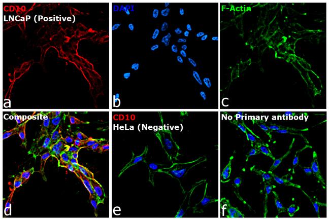 Goat IgG (H+L) Highly Cross-Adsorbed Secondary Antibody in Immunocytochemistry (ICC/IF)