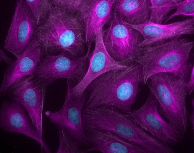 Goat IgG (H+L) Highly Cross-Adsorbed Secondary Antibody in Immunocytochemistry (ICC/IF)