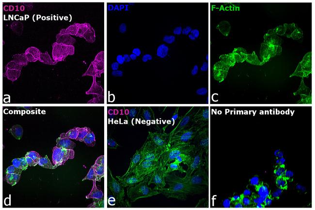 Goat IgG (H+L) Highly Cross-Adsorbed Secondary Antibody in Immunocytochemistry (ICC/IF)