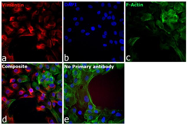 Chicken IgY (H+L) Cross-Adsorbed Secondary Antibody in Immunocytochemistry (ICC/IF)