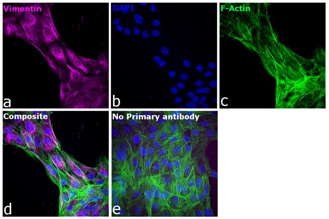 Chicken IgY (H+L) Cross-Adsorbed Secondary Antibody in Immunocytochemistry (ICC/IF)