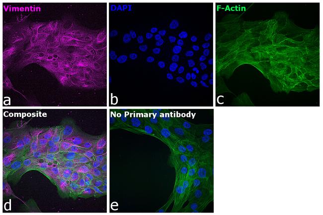 Chicken IgY (H+L) Cross-Adsorbed Secondary Antibody in Immunocytochemistry (ICC/IF)