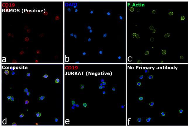 Rat IgG (H+L) Highly Cross-Adsorbed Secondary Antibody in Immunocytochemistry (ICC/IF)