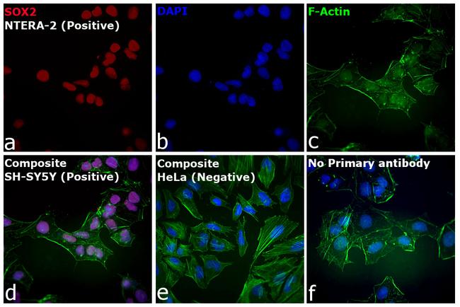 Rat IgG (H+L) Highly Cross-Adsorbed Secondary Antibody in Immunocytochemistry (ICC/IF)