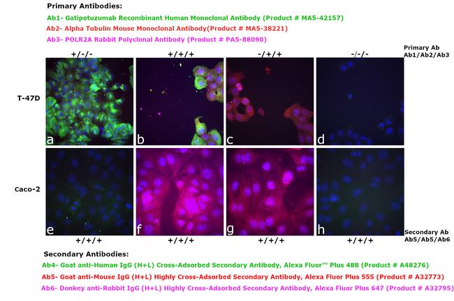 Human IgG (H+L) Cross-Adsorbed Secondary Antibody in Immunocytochemistry (ICC/IF)