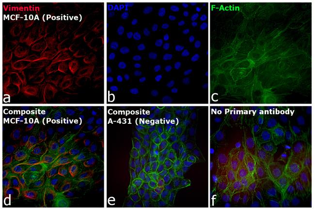 Rabbit IgG (H+L) Cross-Adsorbed Secondary Antibody in Immunocytochemistry (ICC/IF)