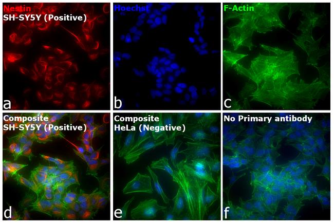 Mouse IgG (H+L) Cross-Adsorbed Secondary Antibody in Immunocytochemistry (ICC/IF)