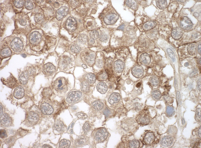 MOV10 Antibody in Immunohistochemistry (Paraffin) (IHC (P))