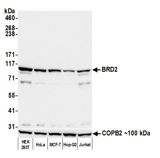 BRD2 Antibody in Western Blot (WB)