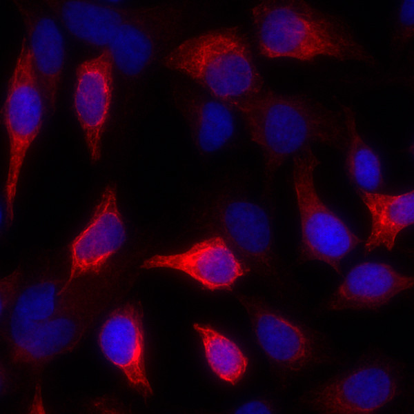 Cytokeratin Antibody in Immunocytochemistry (ICC/IF)