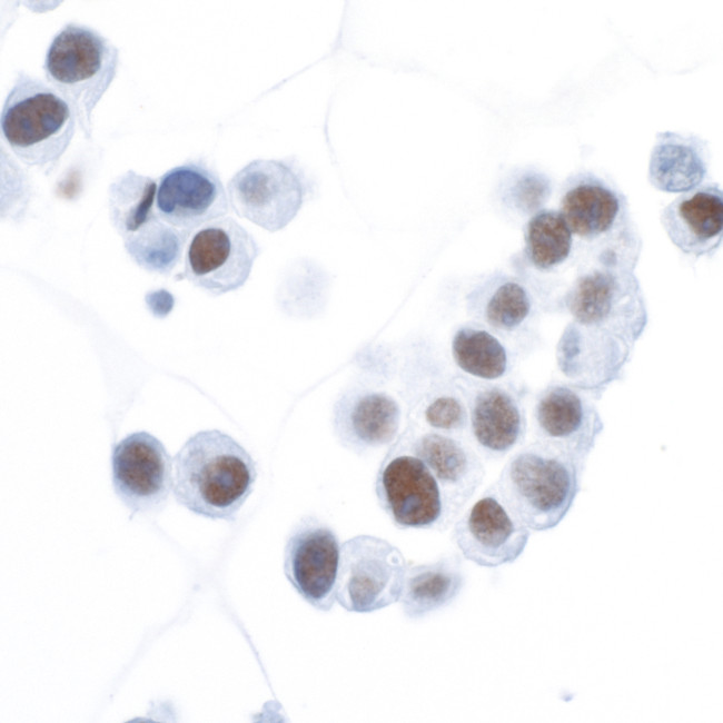 HIF1-alpha Antibody in Immunocytochemistry (ICC/IF)